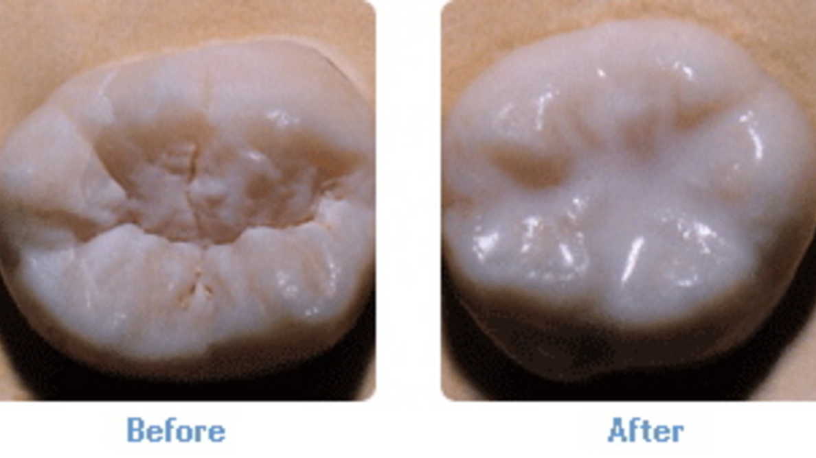sealants sealants